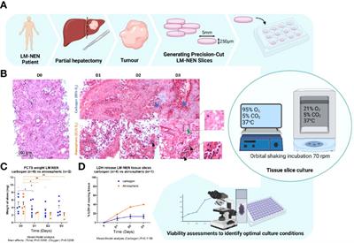 Human Immunocompetent Model of Neuroendocrine Liver Metastases Recapitulates Patient-Specific Tumour Microenvironment